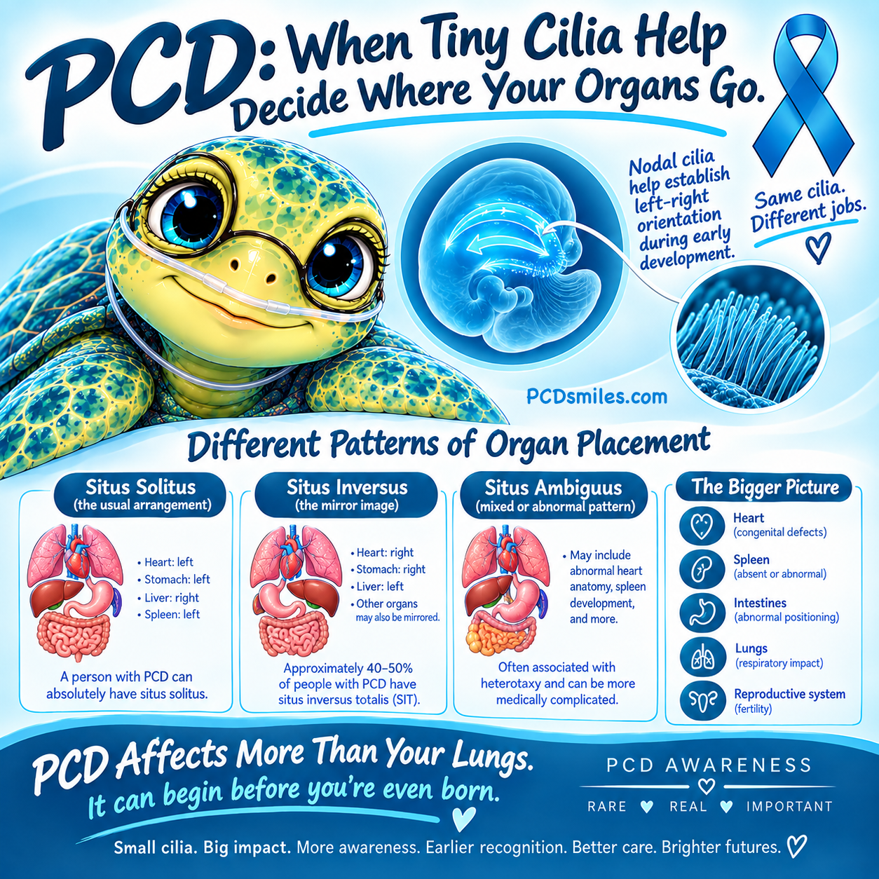 PCD: When Tiny Cilia Help Decide Where Your Organs Go
